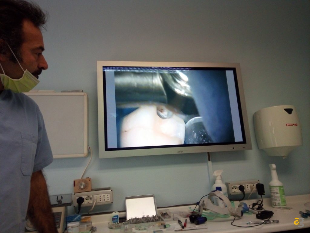 ulefone-gemini-recensione