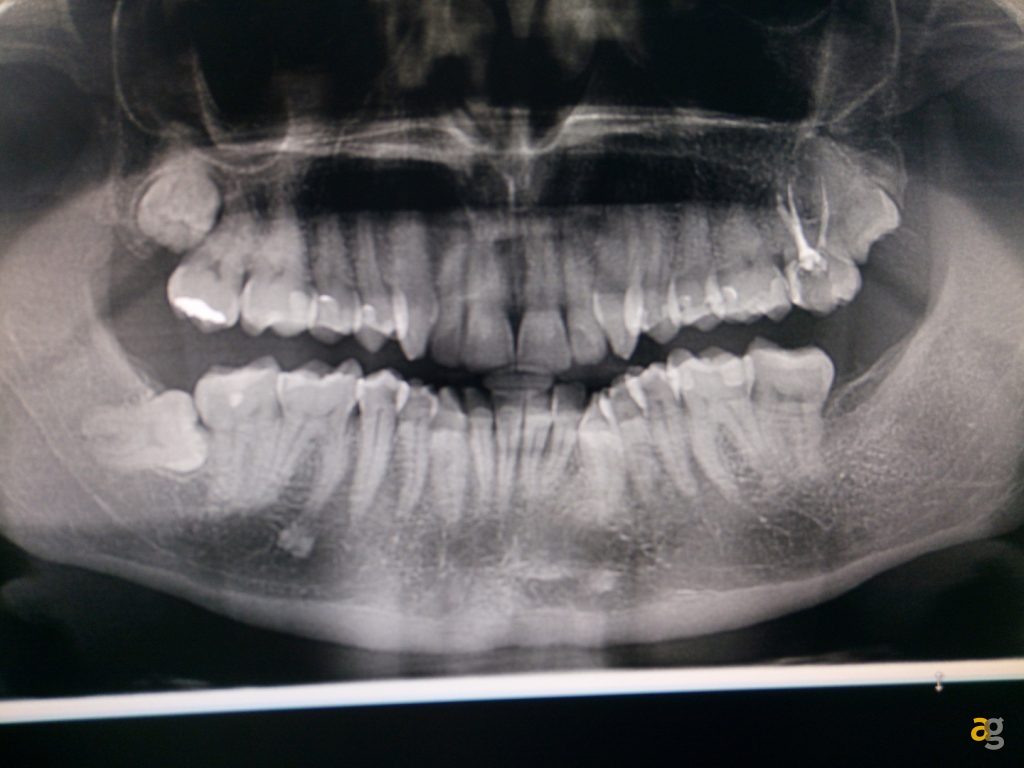 recensione-ulefone-mix